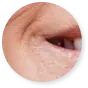 Zone 3: Nase, Wangen und Lippen